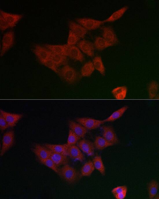 Immunocytochemistry/ Immunofluorescence: GCLM Antibody [NBP3-38134] - Immunofluorescence analysis of PC-12 cells using GCLM Rabbit pAb at dilution of 1:100 (40x lens). Secondary antibody: Cy3-conjugated Goat anti-Rabbit IgG (H+L) at 1:500 dilution. Blue: DAPI for nuclear staining.