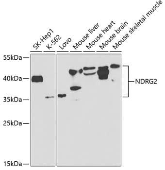 Western Blot: NDRG2 Antibody [NBP3-38135] - Western blot analysis of various lysates using NDRG2 Rabbit pAb at 1:1000 dilution.Secondary antibody: HRP-conjugated Goat anti-Rabbit IgG (H+L) at 1:10000 dilution.Lysates/proteins: 25ug per lane.Blocking buffer: 3% nonfat dry milk in TBST.