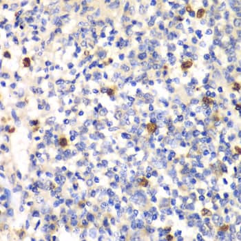 Immunohistochemistry: PSMD7 Antibody [NBP3-38137] - Immunohistochemistry analysis of paraffin-embedded Mouse spleen using PSMD7 Rabbit pAb at dilution of 1:100 (40x lens). Microwave antigen retrieval performed with 0.01M PBS Buffer (pH 7.2) prior to IHC staining.