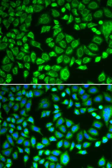 Immunocytochemistry/ Immunofluorescence: PSMD7 Antibody [NBP3-38137] - Immunofluorescence analysis of MCF-7 cells using PSMD7 Rabbit pAb. Secondary antibody: Cy3-conjugated Goat anti-Rabbit IgG (H+L) at 1:500 dilution. Blue: DAPI for nuclear staining.