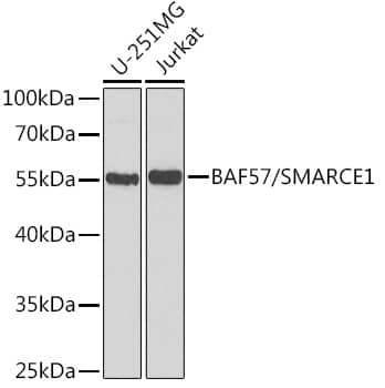 Western Blot: BAF57 Antibody [NBP3-38138] - Western blot analysis of various lysates using BAF57 Rabbit pAb at 1:1000 dilution.Secondary antibody: HRP-conjugated Goat anti-Rabbit IgG (H+L) at 1:10000 dilution.Lysates/proteins: 25ug per lane.Blocking buffer: 3% nonfat dry milk in TBST.Detection: ECL Basic Kit.Exposure time: 90s.