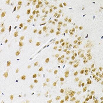 Immunohistochemistry: BAF57 Antibody [NBP3-38138] - Immunohistochemistry analysis of paraffin-embedded Mouse brain using BAF57 Rabbit pAb at dilution of 1:200 (40x lens). Microwave antigen retrieval performed with 0.01M PBS Buffer (pH 7.2) prior to IHC staining.