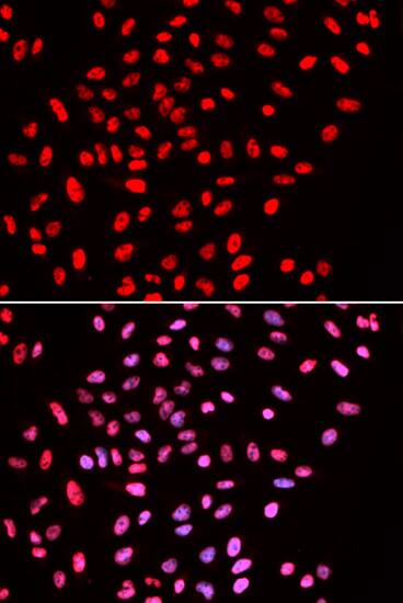 Immunocytochemistry/ Immunofluorescence: BAF57 Antibody [NBP3-38138] - Immunofluorescence analysis of U2OS cells using BAF57 Rabbit pAb. Secondary antibody: Cy3-conjugated Goat anti-Rabbit IgG (H+L) at 1:500 dilution. Blue: DAPI for nuclear staining.