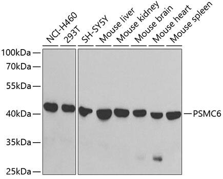 Western Blot: PSMC6 Antibody [NBP3-38139] - Western blot analysis of various lysates using PSMC6 Rabbit pAb at 1:1000 dilution.Secondary antibody: HRP-conjugated Goat anti-Rabbit IgG (H+L) at 1:10000 dilution.Lysates/proteins: 25ug per lane.Blocking buffer: 3% nonfat dry milk in TBST.Detection: ECL Basic Kit.Exposure time: 90s.