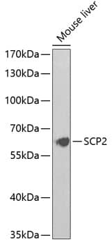 Western Blot: Sterol carrier protein 2 Antibody [NBP3-38141] - Western blot analysis of lysates from mouse liver, using Sterol carrier protein 2 Rabbit pAb at 1:1000 dilution.Secondary antibody: HRP-conjugated Goat anti-Rabbit IgG (H+L) at 1:10000 dilution.Lysates/proteins: 25ug per lane.Blocking buffer: 3% nonfat dry milk in TBST.Detection: ECL Basic Kit.Exposure time: 90s.