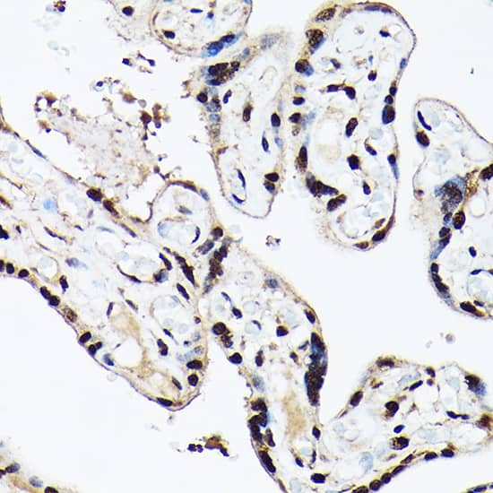 Immunohistochemistry: BAF53A Antibody [NBP3-38142] - Immunohistochemistry analysis of paraffin-embedded Human placenta using BAF53A Rabbit pAb at dilution of 1:100 (40x lens). High pressure antigen retrieval performed with 0.01M Citrate Bufferr (pH 6.0) prior to IHC staining.