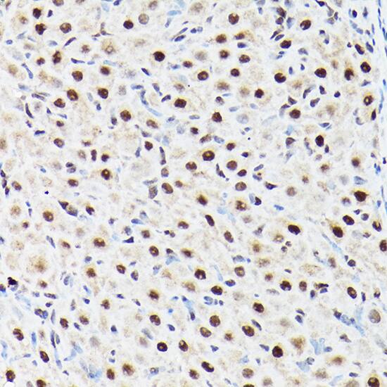 Immunohistochemistry: BAF53A Antibody [NBP3-38142] - Immunohistochemistry analysis of paraffin-embedded Rat ovary using BAF53A Rabbit pAb at dilution of 1:100 (40x lens). High pressure antigen retrieval performed with 0.01M Citrate Bufferr (pH 6.0) prior to IHC staining.