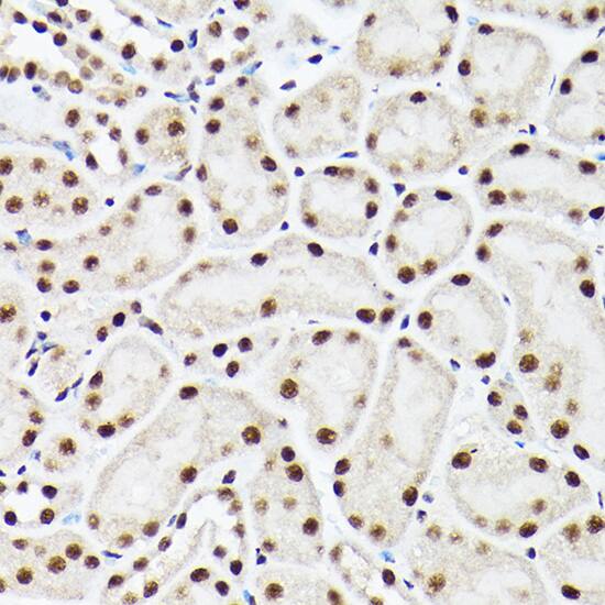 Immunohistochemistry: BAF53A Antibody [NBP3-38142] - Immunohistochemistry analysis of paraffin-embedded Mouse kidney using BAF53A Rabbit pAb at dilution of 1:100 (40x lens). High pressure antigen retrieval performed with 0.01M Citrate Bufferr (pH 6.0) prior to IHC staining.