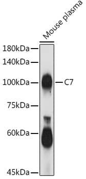 Western Blot: Complement C7 Antibody [NBP3-38143] - Western blot analysis of lysates from Mouse plasma, using Complement C7 Rabbit pAb at 1:1000 dilution.Secondary antibody: HRP-conjugated Goat anti-Rabbit IgG (H+L) at 1:10000 dilution.Lysates/proteins: 25ug per lane.Blocking buffer: 3% nonfat dry milk in TBST.Detection: ECL Basic Kit.Exposure time: 180s.