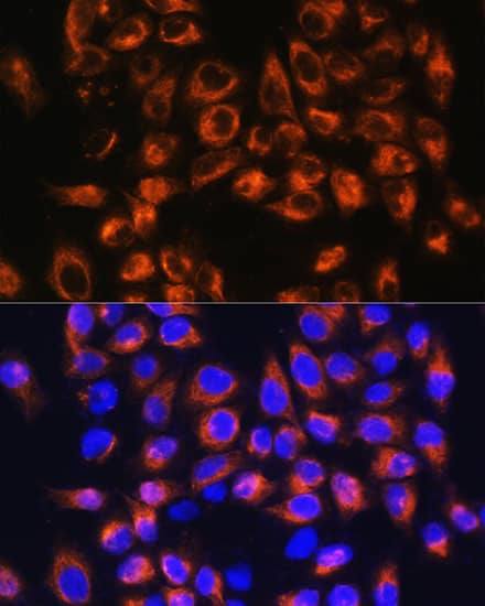 Immunocytochemistry/ Immunofluorescence: Complement C7 Antibody [NBP3-38143] - Immunofluorescence analysis of HeLa cells using Complement C7 Rabbit pAb at dilution of 1:100. Secondary antibody: Cy3-conjugated Goat anti-Rabbit IgG (H+L) at 1:500 dilution. Blue: DAPI for nuclear staining.