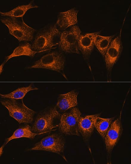 Immunocytochemistry/ Immunofluorescence: Complement C7 Antibody [NBP3-38143] - Immunofluorescence analysis of NIH/3T3 cells using Complement C7 Rabbit pAb at dilution of 1:100. Secondary antibody: Cy3-conjugated Goat anti-Rabbit IgG (H+L) at 1:500 dilution. Blue: DAPI for nuclear staining.