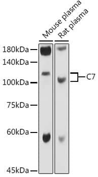 Western Blot: Complement C7 Antibody [NBP3-38143] - Western blot analysis of various lysates using Complement C7 Rabbit pAb at 1:1000 dilution.Secondary antibody: HRP-conjugated Goat anti-Rabbit IgG (H+L) at 1:10000 dilution.Lysates/proteins: 25ug per lane.Blocking buffer: 3% nonfat dry milk in TBST.Detection: ECL Basic Kit.Exposure time: 1s.