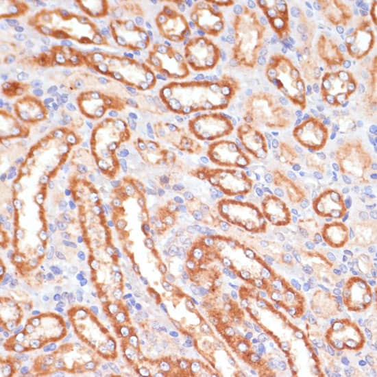 Immunohistochemistry: Cytochrome b5 type A Antibody [NBP3-38144] - Immunohistochemistry analysis of paraffin-embedded Rat kidney using Cytochrome b5 type A Rabbit pAb at dilution of 1:100 (40x lens). Microwave antigen retrieval performed with 0.01M PBS Buffer (pH 7.2) prior to IHC staining.