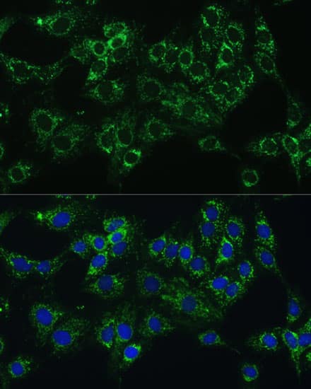 Immunocytochemistry/ Immunofluorescence: Cytochrome b5 type A Antibody [NBP3-38144] - Immunofluorescence analysis of C6 cells using Cytochrome b5 type A Rabbit pAb at dilution of 1:100 (40x lens). Secondary antibody: Cy3-conjugated Goat anti-Rabbit IgG (H+L) at 1:500 dilution. Blue: DAPI for nuclear staining.