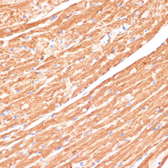 Immunohistochemistry: Cytochrome b5 type A Antibody [NBP3-38144] - Immunohistochemistry analysis of paraffin-embedded Mouse heart using Cytochrome b5 type A Rabbit pAb at dilution of 1:100 (40x lens). Microwave antigen retrieval performed with 0.01M PBS Buffer (pH 7.2) prior to IHC staining.