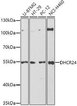 Western Blot: Seladin 1 Antibody [NBP3-38145] - Western blot analysis of various lysates using Seladin 1 Rabbit pAb at 1:1000 dilution.Secondary antibody: HRP-conjugated Goat anti-Rabbit IgG (H+L) at 1:10000 dilution.Lysates/proteins: 25ug per lane.Blocking buffer: 3% nonfat dry milk in TBST.Detection: ECL Basic Kit.Exposure time: 180s.