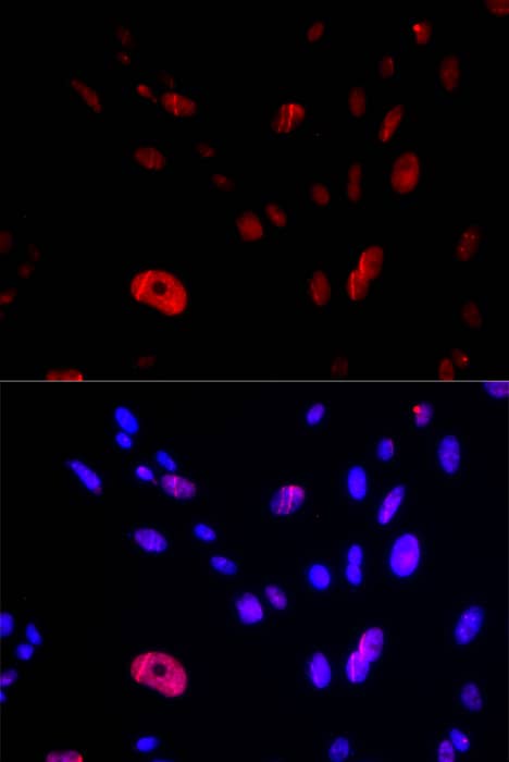 Immunocytochemistry/ Immunofluorescence: HUS1 Antibody [NBP3-38146] - Immunofluorescence analysis of U2OS cells using HUS1 Rabbit pAb. Secondary antibody: Cy3-conjugated Goat anti-Rabbit IgG (H+L) at 1:500 dilution. Blue: DAPI for nuclear staining.