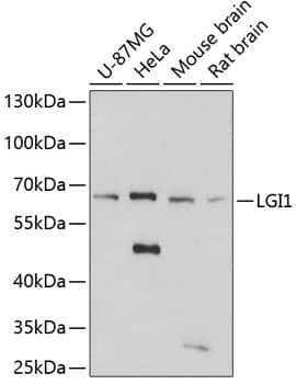 Western Blot: Lgi1 Antibody [NBP3-38147] - Western blot analysis of various lysates using Lgi1 Rabbit pAb at 1:3000 dilution.Secondary antibody: HRP-conjugated Goat anti-Rabbit IgG (H+L) at 1:10000 dilution.Lysates/proteins: 25ug per lane.Blocking buffer: 3% nonfat dry milk in TBST.Detection: ECL Basic Kit.Exposure time: 90s.