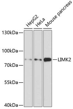 Western Blot: LIM kinase 2 Antibody [NBP3-38148] - Western blot analysis of various lysates using LIM kinase 2 Rabbit pAb at 1:1000 dilution.Secondary antibody: HRP-conjugated Goat anti-Rabbit IgG (H+L) at 1:10000 dilution.Lysates/proteins: 25ug per lane.Blocking buffer: 3% nonfat dry milk in TBST.Detection: ECL Basic Kit.Exposure time: 90s.