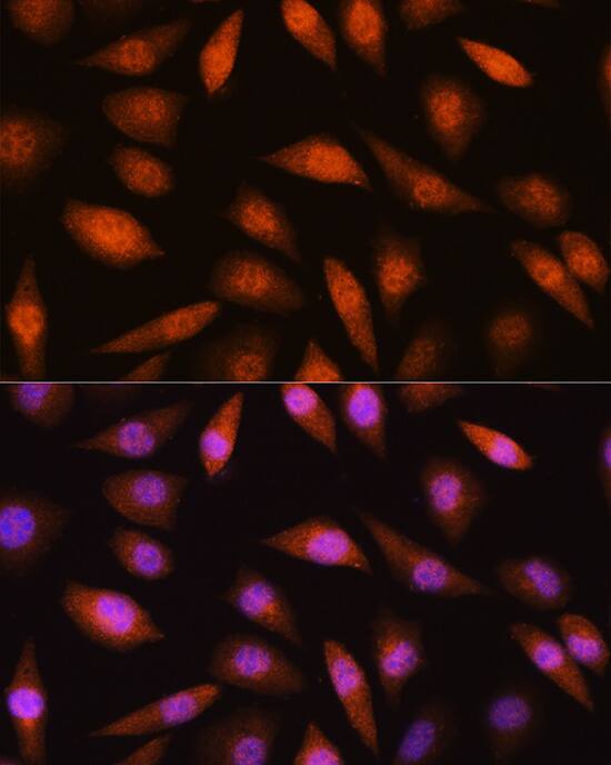 Immunocytochemistry/ Immunofluorescence: LIM kinase 2 Antibody [NBP3-38148] - Immunofluorescence analysis of L929 cells using LIM kinase 2 Rabbit pAb at dilution of 1:100 (40x lens). Secondary antibody: Cy3-conjugated Goat anti-Rabbit IgG (H+L) at 1:500 dilution. Blue: DAPI for nuclear staining.