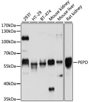 Western Blot: PEPD Antibody [NBP3-38151] - Western blot analysis of various lysates using PEPD Rabbit pAb at 1:1000 dilution.Secondary antibody: HRP-conjugated Goat anti-Rabbit IgG (H+L) at 1:10000 dilution.Lysates/proteins: 25ug per lane.Blocking buffer: 3% nonfat dry milk in TBST.Detection: ECL Basic Kit.Exposure time: 3s.