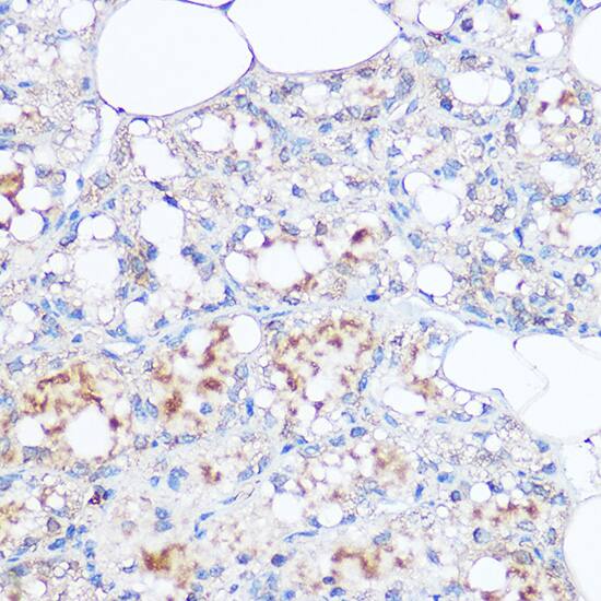 Immunohistochemistry: MGP Antibody [NBP3-38153] - Immunohistochemistry analysis of paraffin-embedded Rat breast using MGP Rabbit pAb at dilution of 1:100 (40x lens). High pressure antigen retrieval performed with 0.01M Citrate Bufferr (pH 6.0) prior to IHC staining.