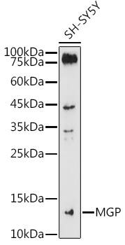 Western Blot: MGP Antibody [NBP3-38153] - Western blot analysis of lysates from SH-SY5Y cells, using MGP Rabbit pAb at 1:1000 dilution.Secondary antibody: HRP-conjugated Goat anti-Rabbit IgG (H+L) at 1:10000 dilution.Lysates/proteins: 25ug per lane.Blocking buffer: 3% nonfat dry milk in TBST.Detection: ECL Basic Kit.Exposure time: 180s.