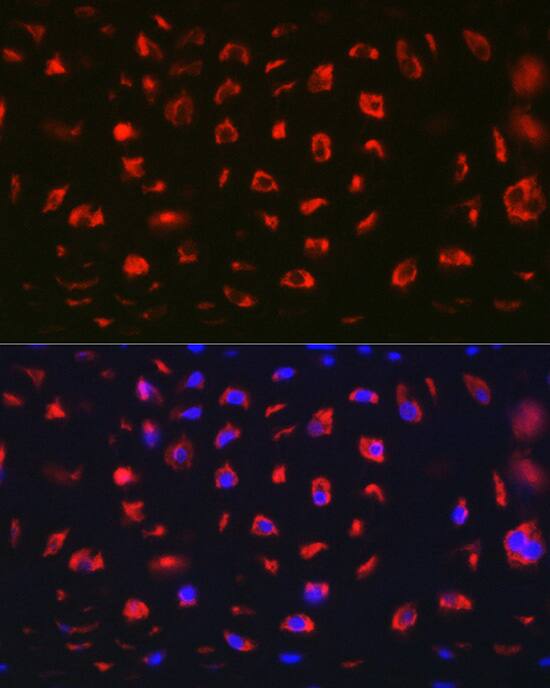 Immunocytochemistry/ Immunofluorescence: MGP Antibody [NBP3-38153] - Immunofluorescence analysis of paraffin-embedded Rat cartilage using MGP Rabbit pAb at dilution of 1:100 (40x lens). Secondary antibody: Cy3-conjugated Goat anti-Rabbit IgG (H+L) at 1:500 dilution. Blue: DAPI for nuclear staining.