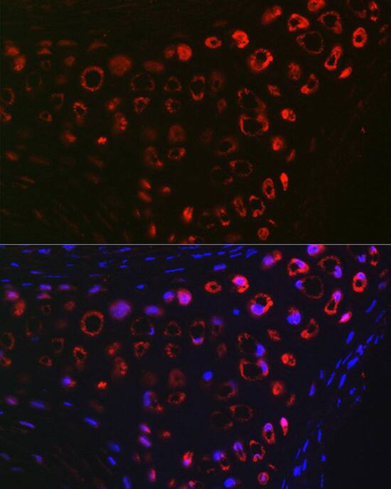 Immunocytochemistry/ Immunofluorescence: MGP Antibody [NBP3-38153] - Immunofluorescence analysis of paraffin-embedded Mouse cartilage using MGP Rabbit pAb at dilution of 1:100 (40x lens). Secondary antibody: Cy3-conjugated Goat anti-Rabbit IgG (H+L) at 1:500 dilution. Blue: DAPI for nuclear staining.