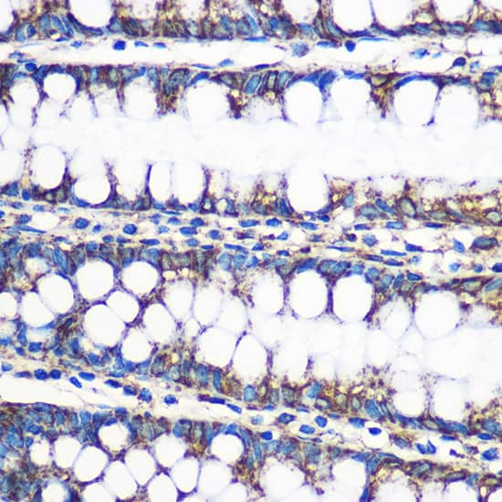 Immunohistochemistry: ERAB Antibody [NBP3-38154] - Immunohistochemistry analysis of paraffin-embedded Human colon using ERAB/ERAB/HSD17B10 Rabbit pAb (A5448) at dilution of 1:100 (40x lens).Perform microwave antigen retrieval with 10 mM PBS buffer pH 7.2 before commencing with IHC staining protocol.