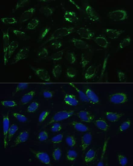 Immunocytochemistry/ Immunofluorescence: ERAB Antibody [NBP3-38154] - Immunofluorescence analysis of U-2 OS cells using ERAB Rabbit pAb at dilution of 1:100 (40x lens). Secondary antibody: Cy3 Goat Anti-Rabbit IgG (H+L) at 1:500 dilution. Blue: DAPI for nuclear staining.