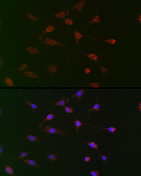 Immunocytochemistry/ Immunofluorescence UBE2R1/CDC34 Antibody - BSA Free