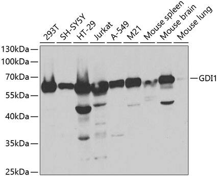 Western Blot: GDI1 Antibody [NBP3-38157] - Western blot analysis of various lysates using GDI1 Rabbit pAb at 1:1000 dilution.Secondary antibody: HRP-conjugated Goat anti-Rabbit IgG (H+L) at 1:10000 dilution.Lysates/proteins: 25ug per lane.Blocking buffer: 3% nonfat dry milk in TBST.Detection: ECL Basic Kit.Exposure time: 5s.