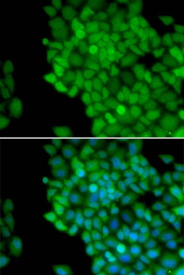 Immunocytochemistry/ Immunofluorescence MAGEA1 Antibody