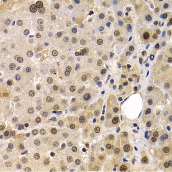 Immunohistochemistry MAGEA1 Antibody