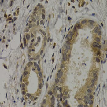 Immunohistochemistry MAGEA1 Antibody