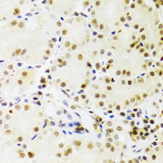 Immunohistochemistry: PRPF3 Antibody [NBP3-38160] - Immunohistochemistry analysis of paraffin-embedded Human stomach using PRPF3 Rabbit pAb at dilution of 1:100 (40x lens). Microwave antigen retrieval performed with 0.01M PBS Buffer (pH 7.2) prior to IHC staining.