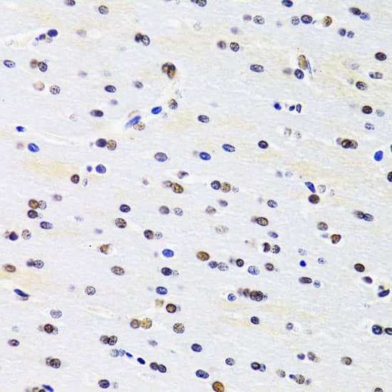 Immunohistochemistry: PRPF3 Antibody [NBP3-38160] - Immunohistochemistry analysis of paraffin-embedded Rat brain using PRPF3 Rabbit pAb at dilution of 1:100 (40x lens). Microwave antigen retrieval performed with 0.01M PBS Buffer (pH 7.2) prior to IHC staining.