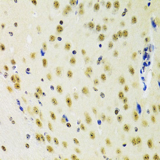 Immunohistochemistry PRPF3 Antibody