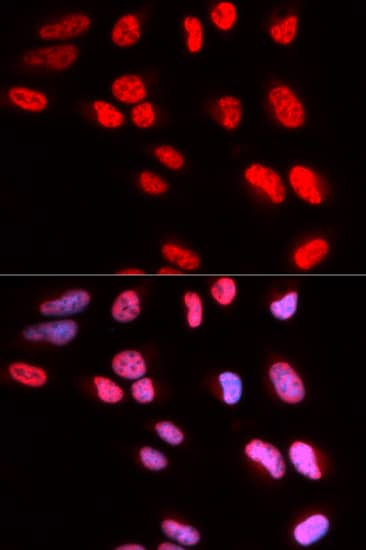 Immunocytochemistry/ Immunofluorescence PRPF3 Antibody