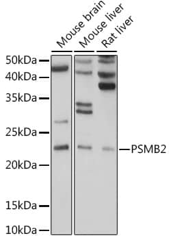 Western Blot: Proteasome 20S beta2 Antibody [NBP3-38161] - Western blot analysis of various lysates using Proteasome 20S beta2 Rabbit pAb at 1:1000 dilution.Secondary antibody: HRP-conjugated Goat anti-Rabbit IgG (H+L) at 1:10000 dilution.Lysates/proteins: 25ug per lane.Blocking buffer: 3% nonfat dry milk in TBST.Detection: ECL Basic Kit.Exposure time: 10s.