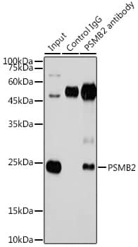 Immunoprecipitation Proteasome 20S beta2 Antibody