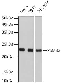 Western Blot: Proteasome 20S beta2 Antibody [NBP3-38161] - Western blot analysis of various lysates using Proteasome 20S beta2 Rabbit pAb at 1:1000 dilution.Secondary antibody: HRP-conjugated Goat anti-Rabbit IgG (H+L) at 1:10000 dilution.Lysates/proteins: 25ug per lane.Blocking buffer: 3% nonfat dry milk in TBST.Detection: ECL Basic Kit.Exposure time: 1s.