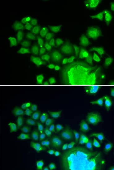 Immunocytochemistry/ Immunofluorescence: FZR1/CDH1 Antibody [NBP3-38164] - Immunofluorescence analysis of HeLa cells using FZR1/CDH1 Rabbit pAb. Secondary antibody: Cy3-conjugated Goat anti-Rabbit IgG (H+L) at 1:500 dilution. Blue: DAPI for nuclear staining.