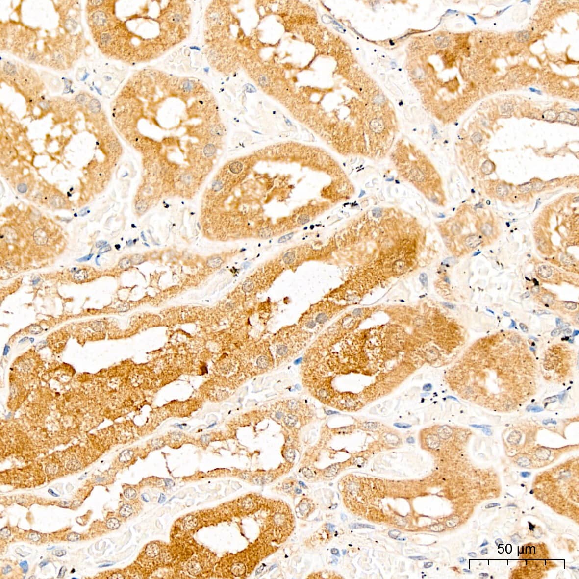 Immunohistochemistry: PSMF1 Antibody [NBP3-38166] - Immunohistochemistry analysis of paraffin-embedded Human kidney tissue using PSMF1 Rabbit pAb at a dilution of  1:100 (40x lens). High pressure antigen retrieval was performed with 0.01 M citrate buffer (pH 6.0) prior to IHC staining.