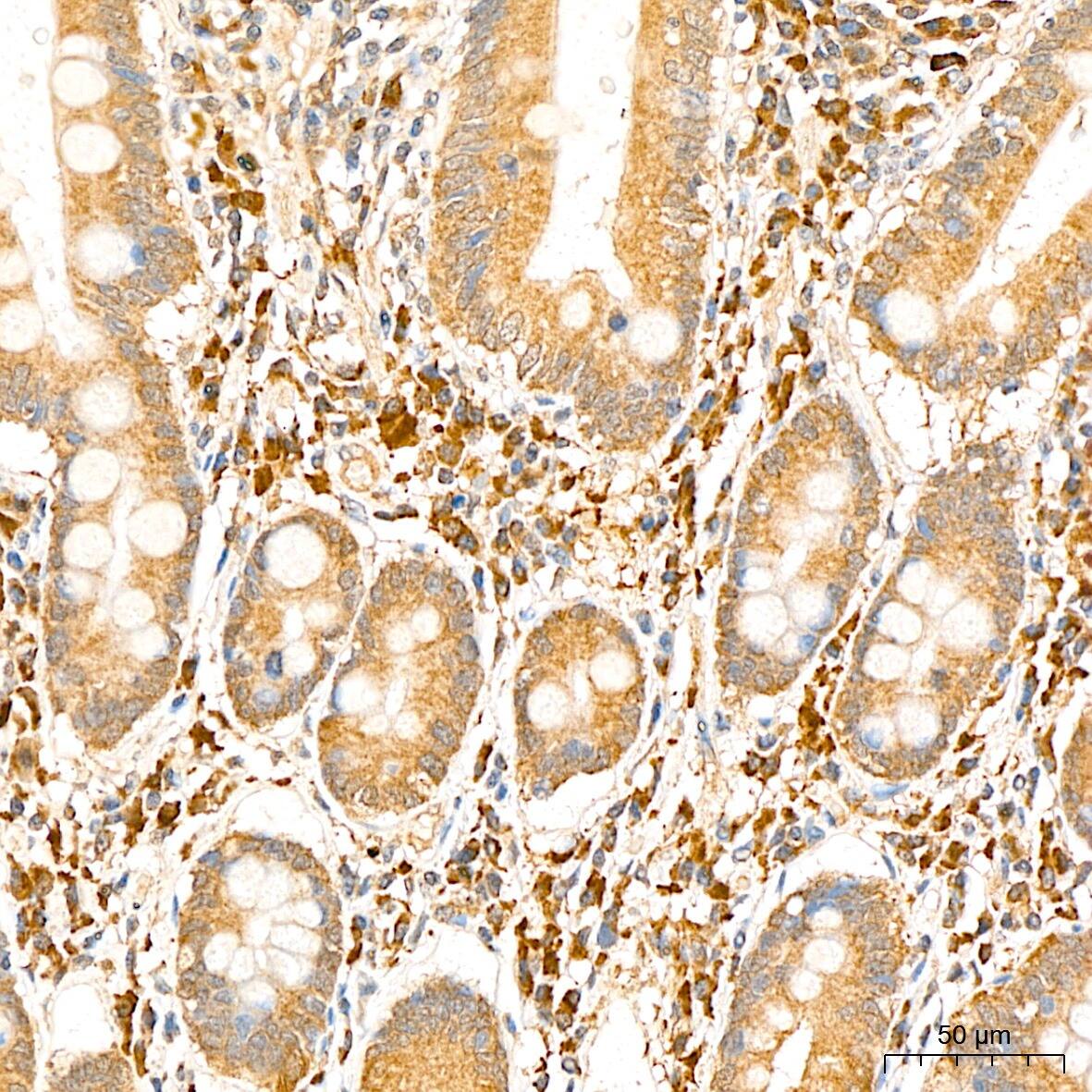 Immunohistochemistry: PSMF1 Antibody [NBP3-38166] - Immunohistochemistry analysis of paraffin-embedded Human colon tissue using PSMF1 Rabbit pAb at a dilution of  1:100 (40x lens). High pressure antigen retrieval was performed with 0.01 M citrate buffer (pH 6.0) prior to IHC staining.