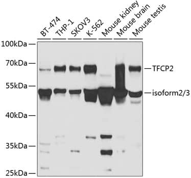 Western Blot: TFCP2 Antibody [NBP3-38167] - Western blot analysis of various lysates using TFCP2 Rabbit pAb at 1:1000 dilution.Secondary antibody: HRP-conjugated Goat anti-Rabbit IgG (H+L) at 1:10000 dilution.Lysates/proteins: 25ug per lane.Blocking buffer: 3% nonfat dry milk in TBST.Detection: ECL Basic Kit.Exposure time: 5s.