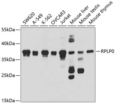 Western Blot: RPLP0 Antibody [NBP3-38169] - Western blot analysis of various lysates using RPLP0 Rabbit pAb at 1:1000 dilution.Secondary antibody: HRP-conjugated Goat anti-Rabbit IgG (H+L) at 1:10000 dilution.Lysates/proteins: 25ug per lane.Blocking buffer: 3% nonfat dry milk in TBST.Detection: ECL Basic Kit.Exposure time: 30s.