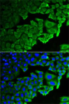 Immunocytochemistry/ Immunofluorescence: RPLP0 Antibody [NBP3-38169] - Immunofluorescence analysis of HeLa cells using RPLP0 Rabbit pAb. Secondary antibody: Cy3-conjugated Goat anti-Rabbit IgG (H+L) at 1:500 dilution. Blue: DAPI for nuclear staining.