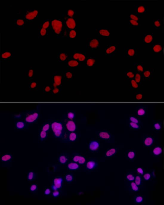 Immunocytochemistry/ Immunofluorescence: CREM Antibody [NBP3-38171] - Immunofluorescence analysis of PC-3 cells using CREM Rabbit pAb at dilution of 1:50 (40x lens). Secondary antibody: Cy3-conjugated Goat anti-Rabbit IgG (H+L) at 1:500 dilution. Blue: DAPI for nuclear staining.